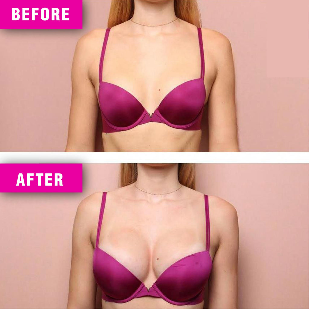 Breast Growth Kit